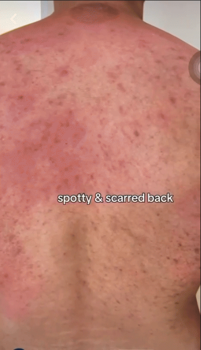 GIF 17