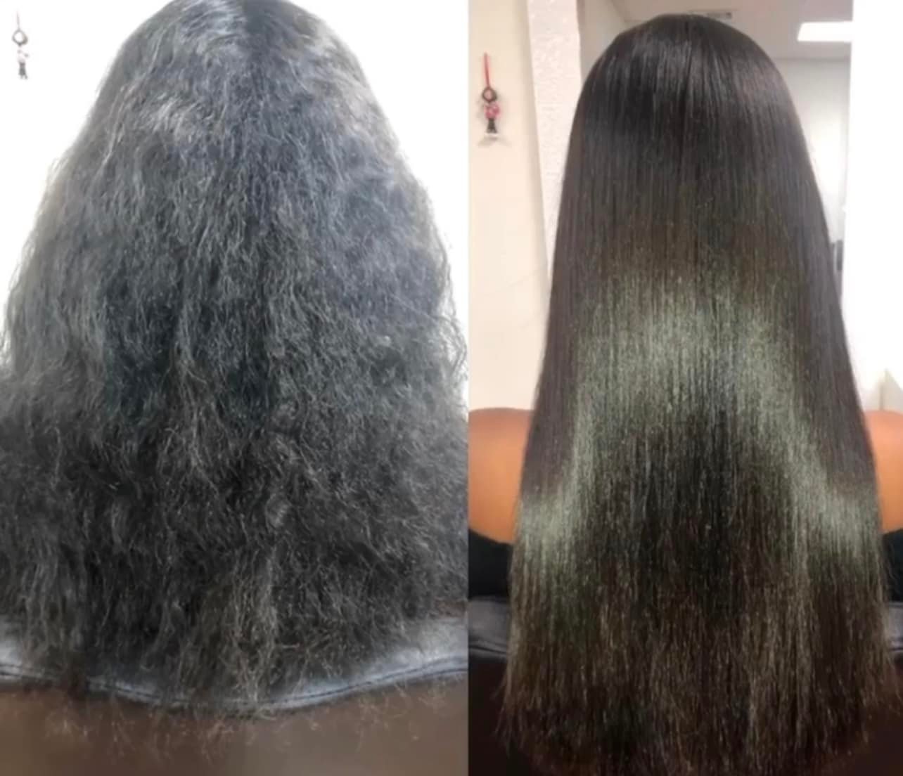 Full Body Laser Hair Removal