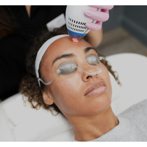 LASER FACIAL