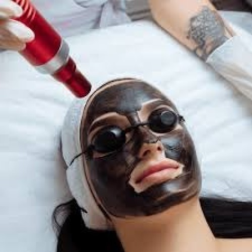 HOLLYWOOD CARBON LASER FACIAL