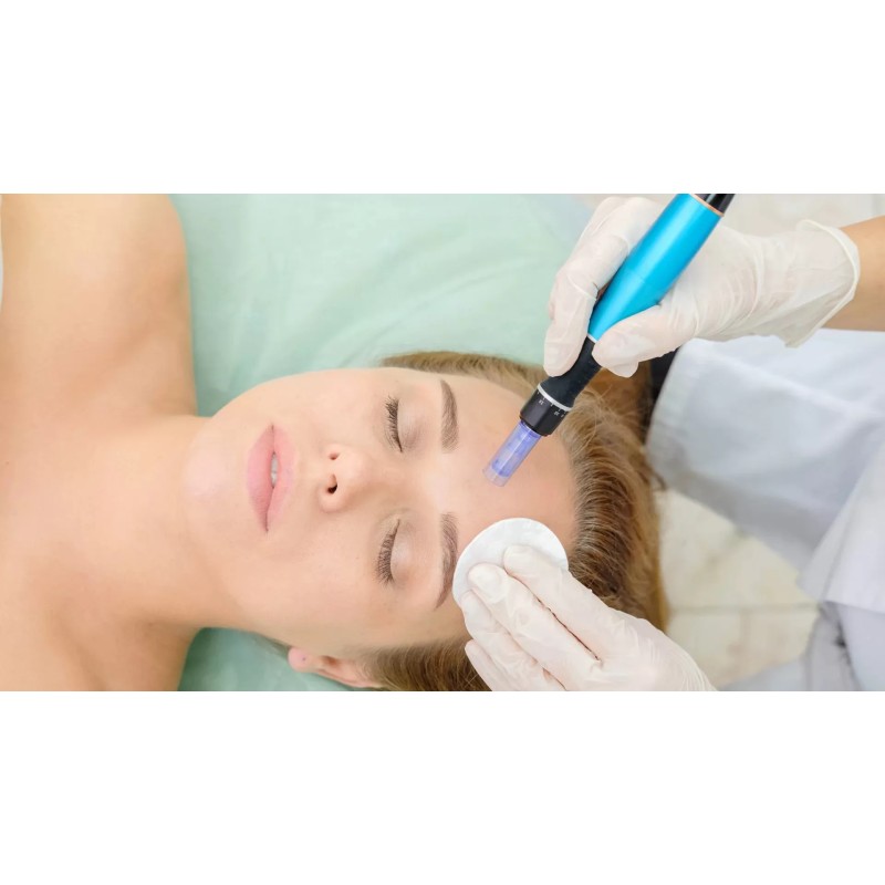 Micro-needling Micro-needling