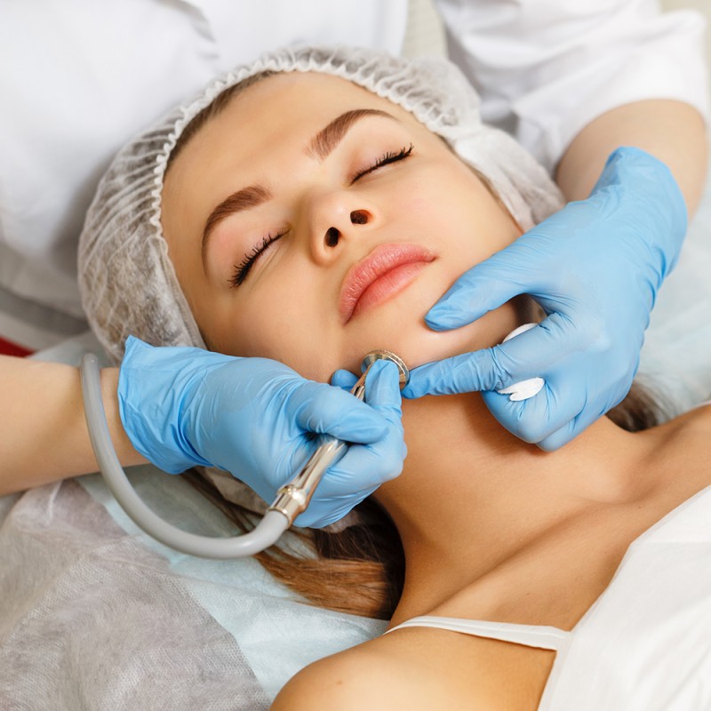 Microdermabrasion on go Microdermabrasion on go